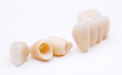 Crowns for front and back teeth