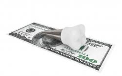 Dental Implant Cost
