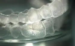 Invisalign