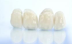 Zirconia crowns