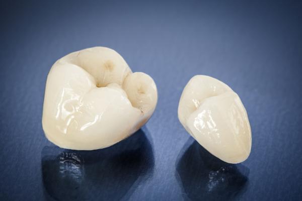 All porcelain crowns