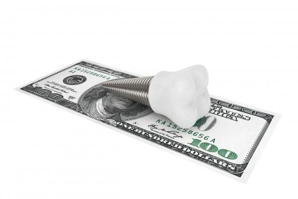 Dental Implants Cost