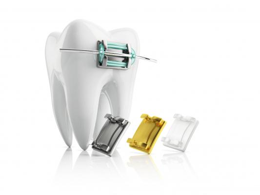 Various colors for metal braces