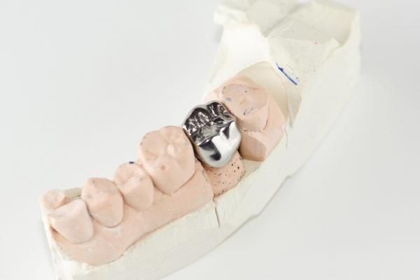 Metal dental crown