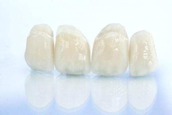 Multiple zirconia crowns