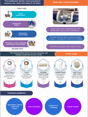 Dental Crowns Infographic